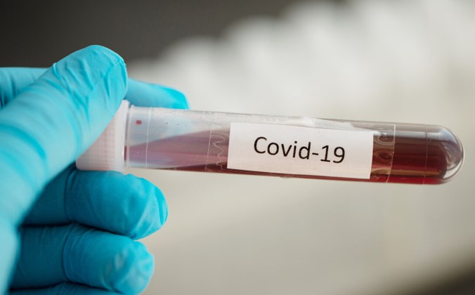 COVID-19 test