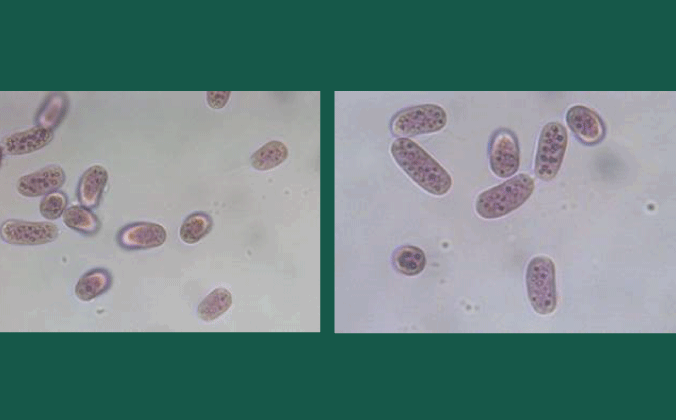 Chromatium okenii, lilla svovlbakterie. Foto: Maria Temponeras, Planktontax